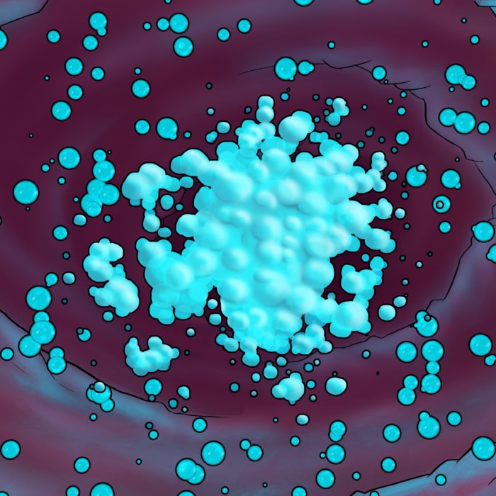Microbubbles and theranostics