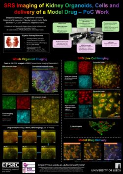 SRS Imaging of Kidney Organoids, Cells and delivery of a Model Drug – PoC Work